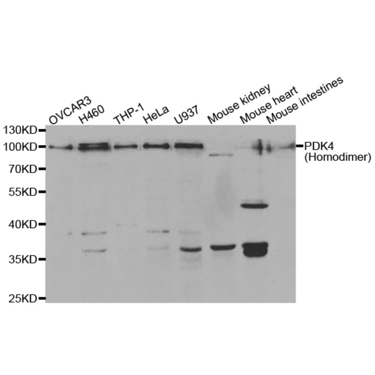 Western blot - PDK4 antibody from Signalway Antibody (38562) - Antibodies.com