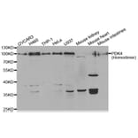 Western blot - PDK4 antibody from Signalway Antibody (38562) - Antibodies.com