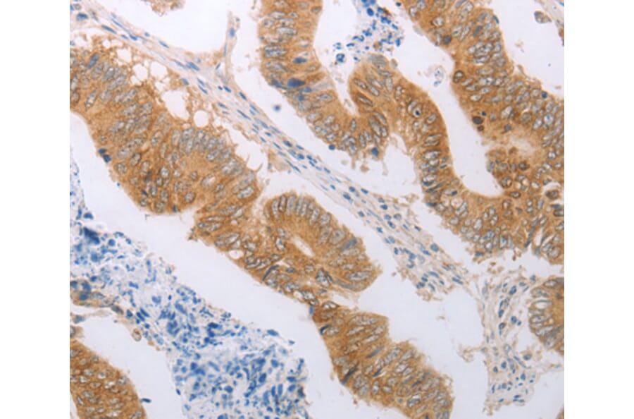 Immunohistochemistry - PDK4 antibody from Signalway Antibody (38562) - Antibodies.com