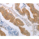 Immunohistochemistry - PDK4 antibody from Signalway Antibody (38562) - Antibodies.com