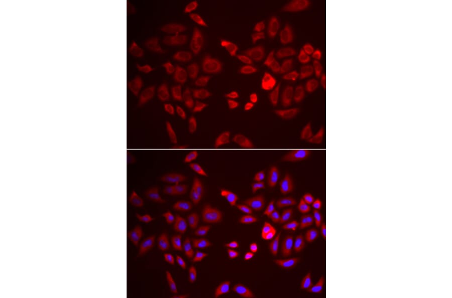 Immunofluorescence - PDK4 antibody from Signalway Antibody (38562) - Antibodies.com