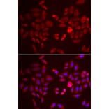 Immunofluorescence - PDK4 antibody from Signalway Antibody (38562) - Antibodies.com