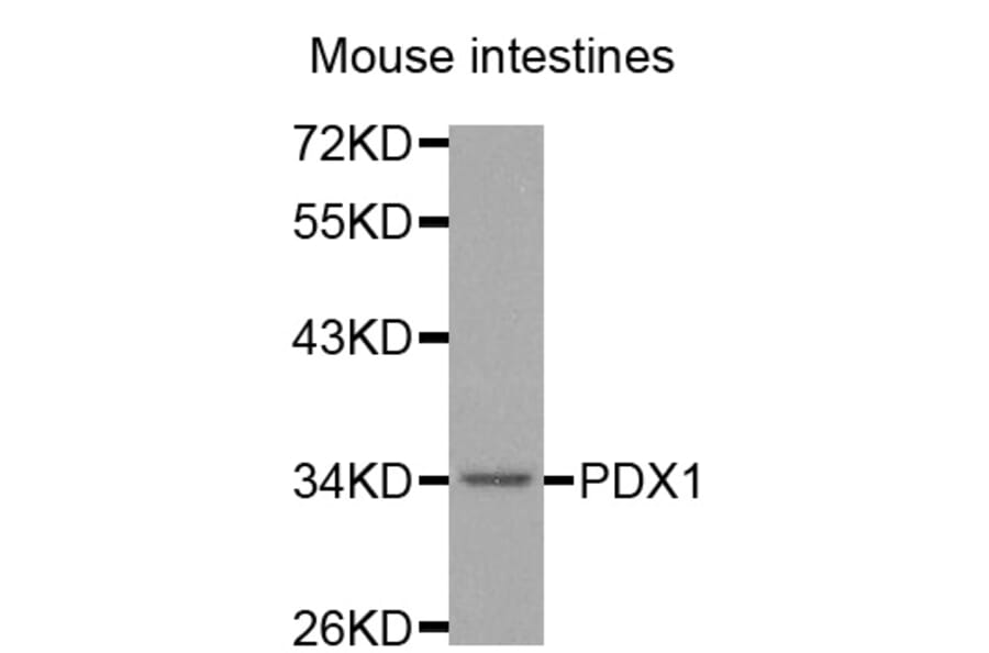 Western blot - PDX1 antibody from Signalway Antibody (38563) - Antibodies.com