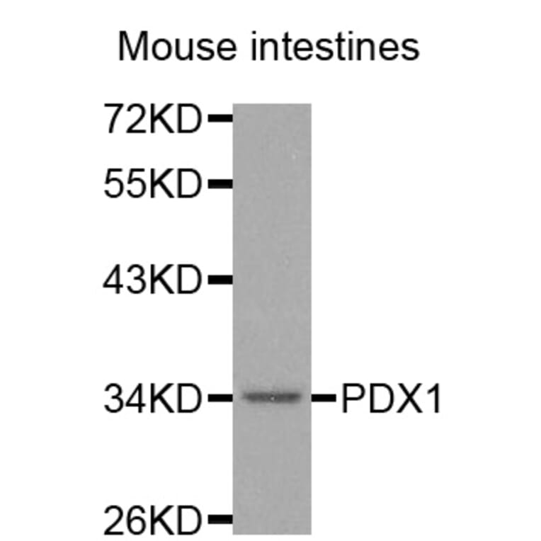 Western blot - PDX1 antibody from Signalway Antibody (38563) - Antibodies.com