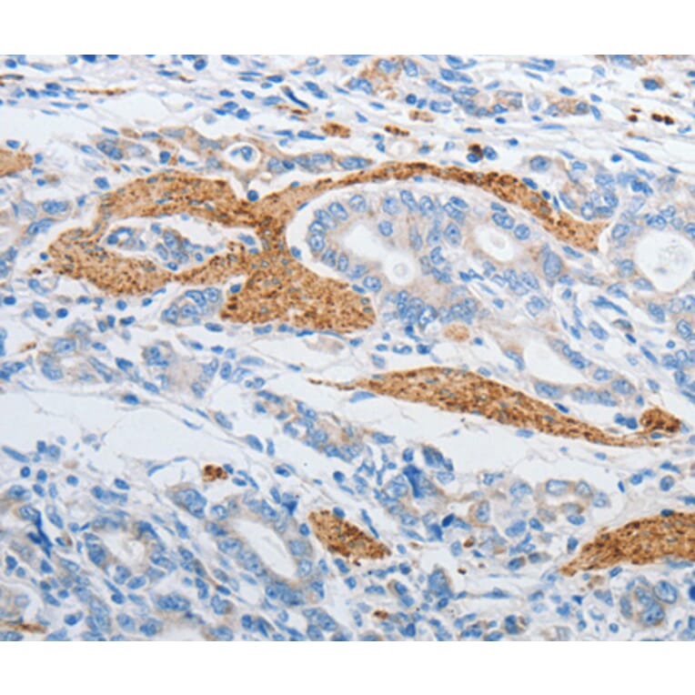 Immunohistochemistry - PDX1 antibody from Signalway Antibody (38563) - Antibodies.com