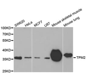 Western blot - TPM2 antibody from Signalway Antibody (38576) - Antibodies.com