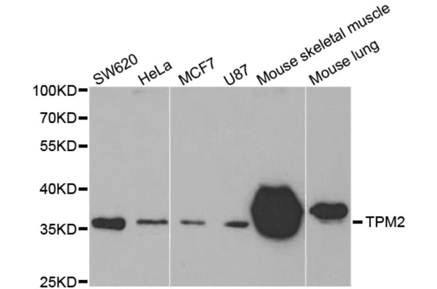 Western blot - TPM2 antibody from Signalway Antibody (38576) - Antibodies.com