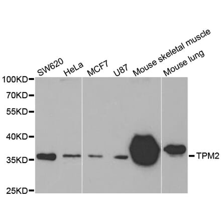 Western blot - TPM2 antibody from Signalway Antibody (38576) - Antibodies.com