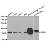 Western blot - TPM2 antibody from Signalway Antibody (38576) - Antibodies.com