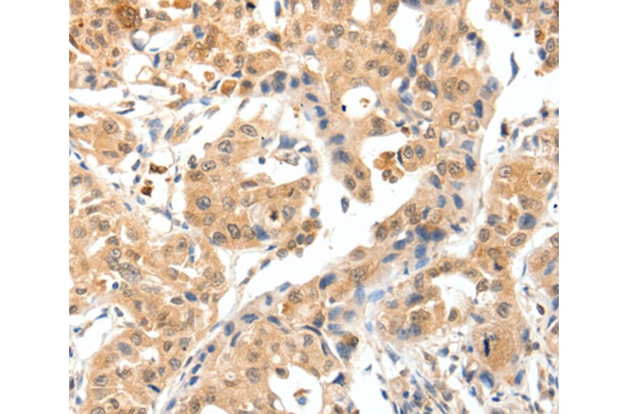 Immunohistochemistry - TPM2 antibody from Signalway Antibody (38576) - Antibodies.com