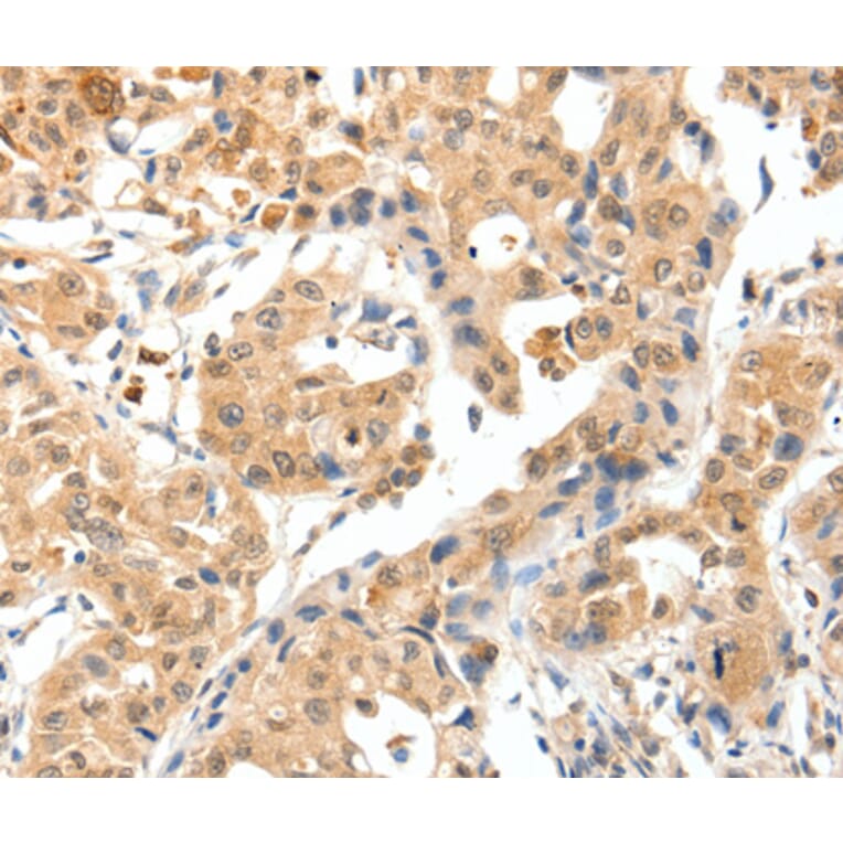 Immunohistochemistry - TPM2 antibody from Signalway Antibody (38576) - Antibodies.com