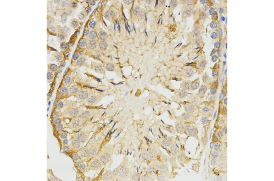 Immunohistochemistry - TPM2 antibody from Signalway Antibody (38576) - Antibodies.com