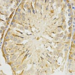 Immunohistochemistry - TPM2 antibody from Signalway Antibody (38576) - Antibodies.com