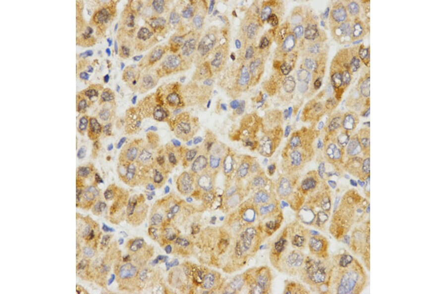 Immunohistochemistry - TPM2 antibody from Signalway Antibody (38576) - Antibodies.com