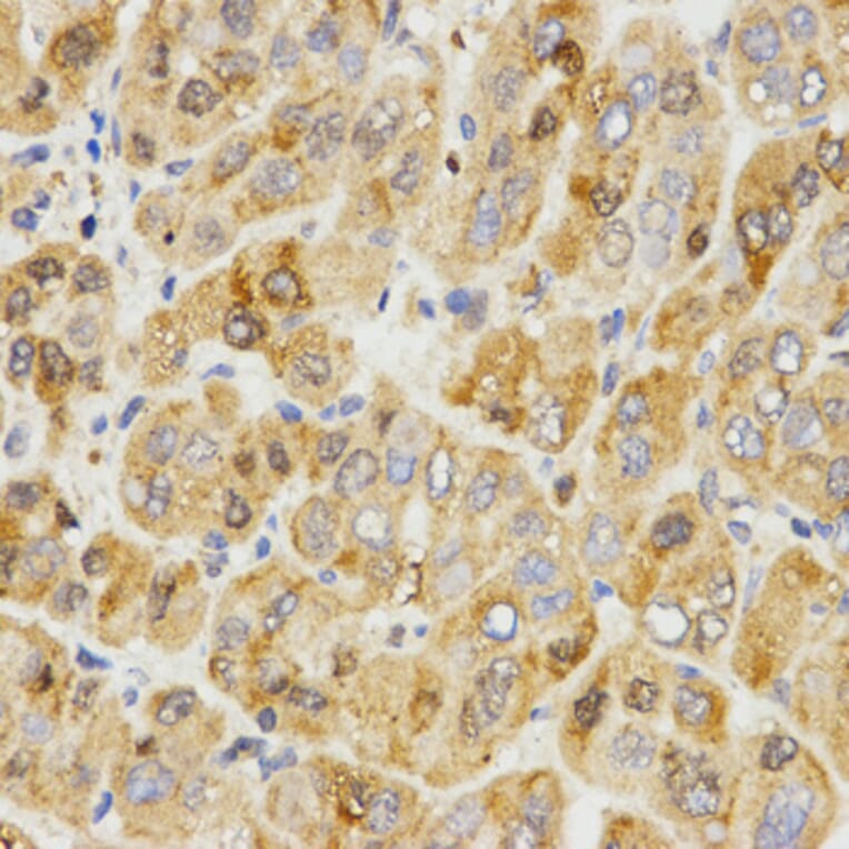 Immunohistochemistry - TPM2 antibody from Signalway Antibody (38576) - Antibodies.com