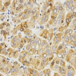 Immunohistochemistry - TPM2 antibody from Signalway Antibody (38576) - Antibodies.com
