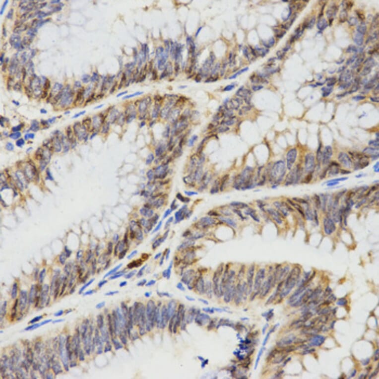 Immunohistochemistry - TPM2 antibody from Signalway Antibody (38576) - Antibodies.com