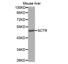 Western blot - SCTR antibody from Signalway Antibody (38595) - Antibodies.com