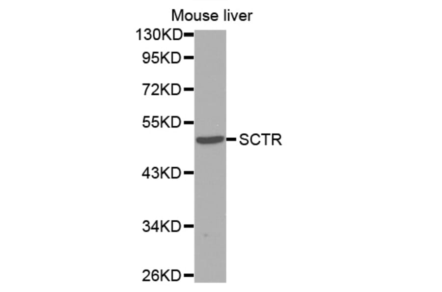 Western blot - SCTR antibody from Signalway Antibody (38595) - Antibodies.com