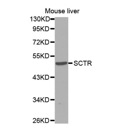 Western blot - SCTR antibody from Signalway Antibody (38595) - Antibodies.com
