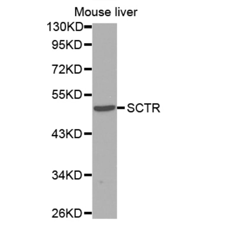 Western blot - SCTR antibody from Signalway Antibody (38595) - Antibodies.com