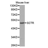 Western blot - SCTR antibody from Signalway Antibody (38595) - Antibodies.com