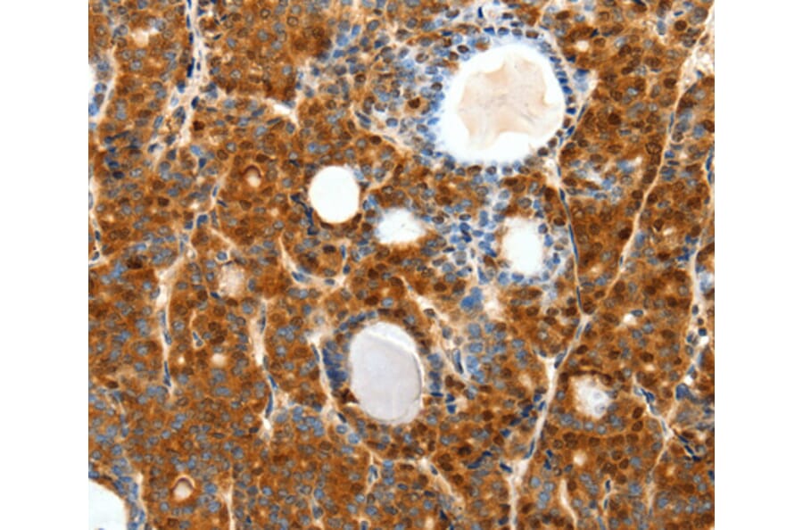 Immunohistochemistry - SCTR antibody from Signalway Antibody (38595) - Antibodies.com