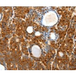 Immunohistochemistry - SCTR antibody from Signalway Antibody (38595) - Antibodies.com