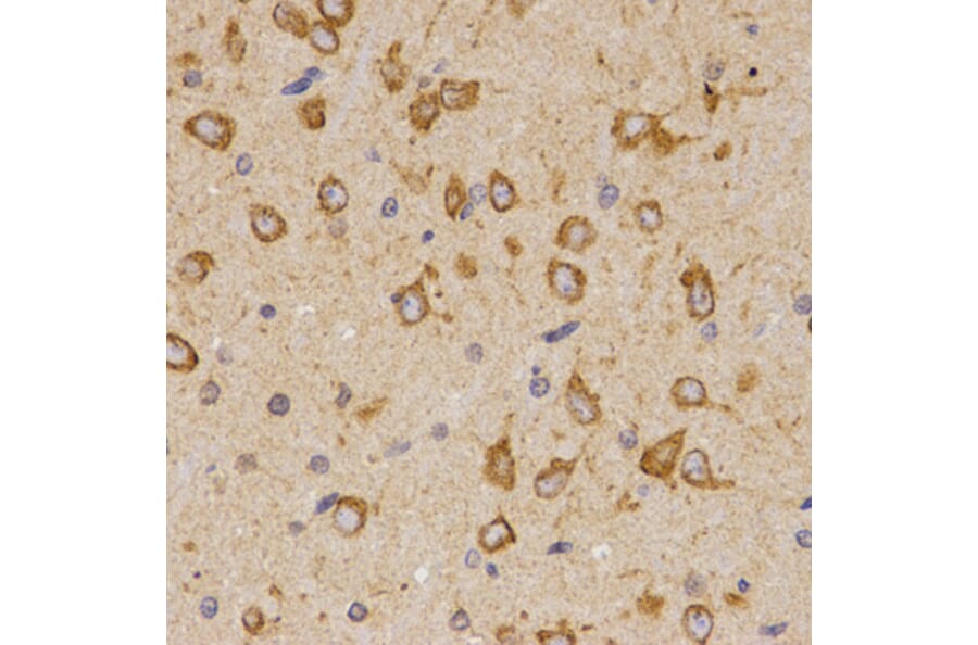 Immunohistochemistry - SCTR antibody from Signalway Antibody (38595) - Antibodies.com