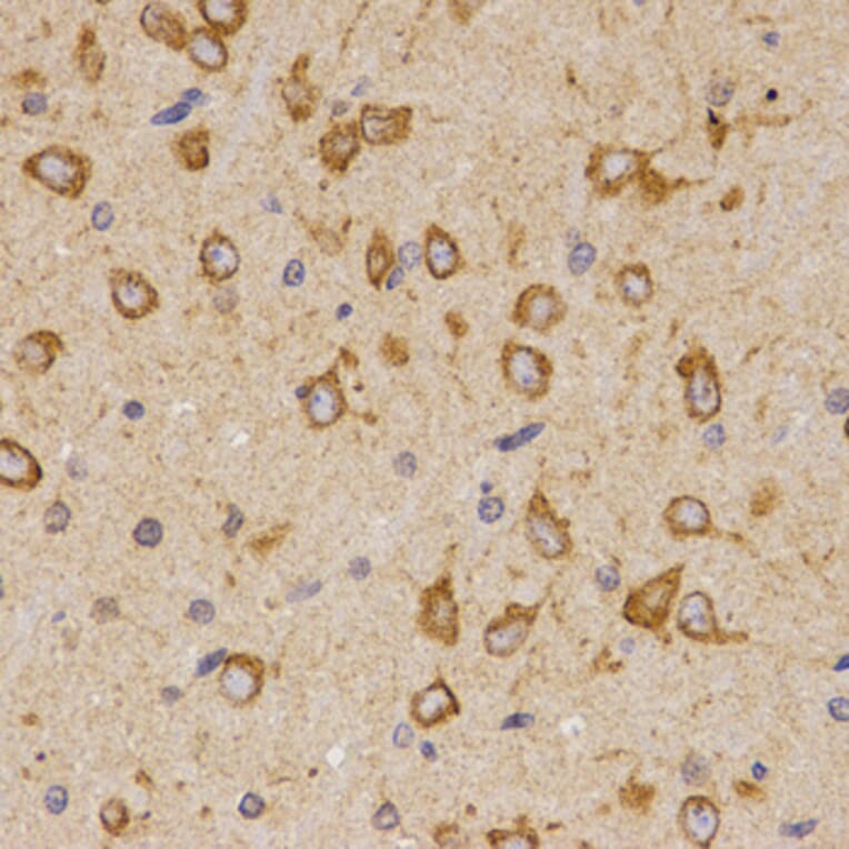 Immunohistochemistry - SCTR antibody from Signalway Antibody (38595) - Antibodies.com