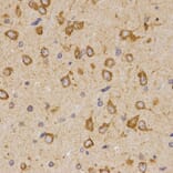 Immunohistochemistry - SCTR antibody from Signalway Antibody (38595) - Antibodies.com