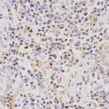 Immunohistochemistry - SCTR antibody from Signalway Antibody (38595) - Antibodies.com