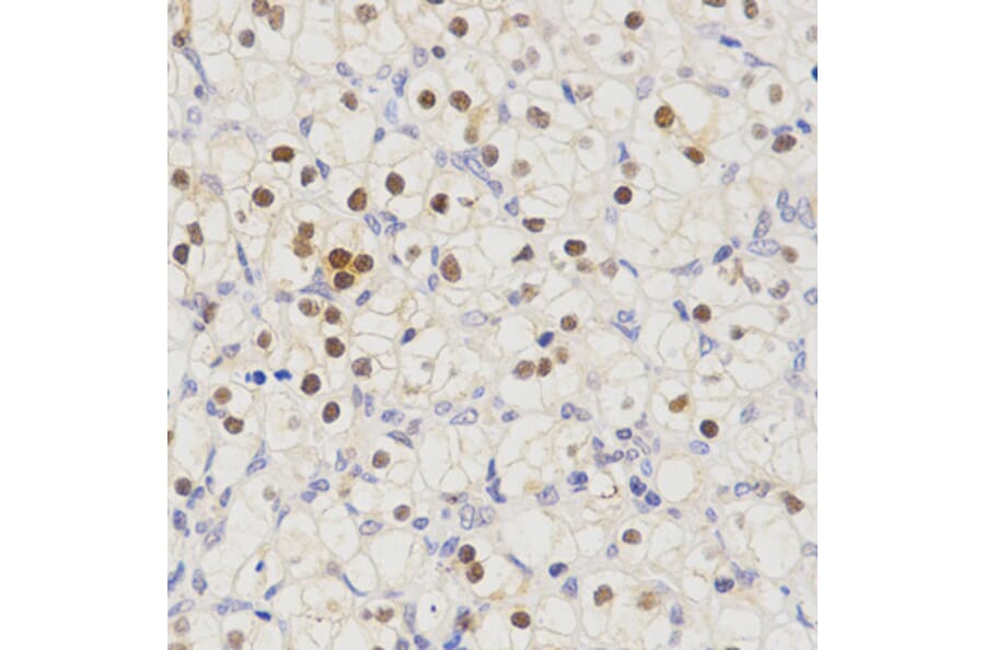Immunohistochemistry - SCTR antibody from Signalway Antibody (38595) - Antibodies.com