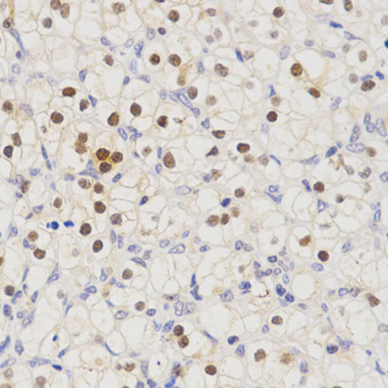 Immunohistochemistry - SCTR antibody from Signalway Antibody (38595) - Antibodies.com