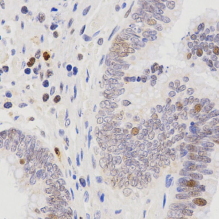 Immunohistochemistry - SCTR antibody from Signalway Antibody (38595) - Antibodies.com