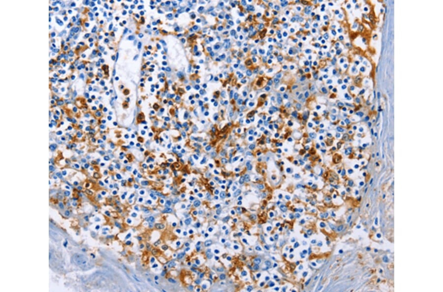 Immunohistochemistry - AIF1 antibody from Signalway Antibody (38603) - Antibodies.com