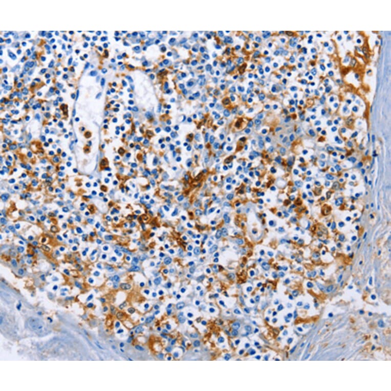 Immunohistochemistry - AIF1 antibody from Signalway Antibody (38603) - Antibodies.com