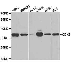 Western blot - CDK6 antibody from Signalway Antibody (38607) - Antibodies.com