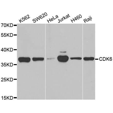 Western blot - CDK6 antibody from Signalway Antibody (38607) - Antibodies.com