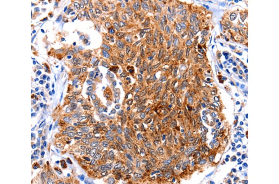 Immunohistochemistry - CUL3 antibody from Signalway Antibody (38610) - Antibodies.com