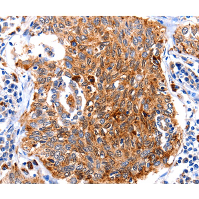 Immunohistochemistry - CUL3 antibody from Signalway Antibody (38610) - Antibodies.com