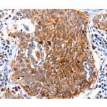 Immunohistochemistry - CUL3 antibody from Signalway Antibody (38610) - Antibodies.com