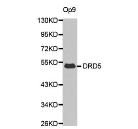 Western blot - DRD5 antibody from Signalway Antibody (38612) - Antibodies.com