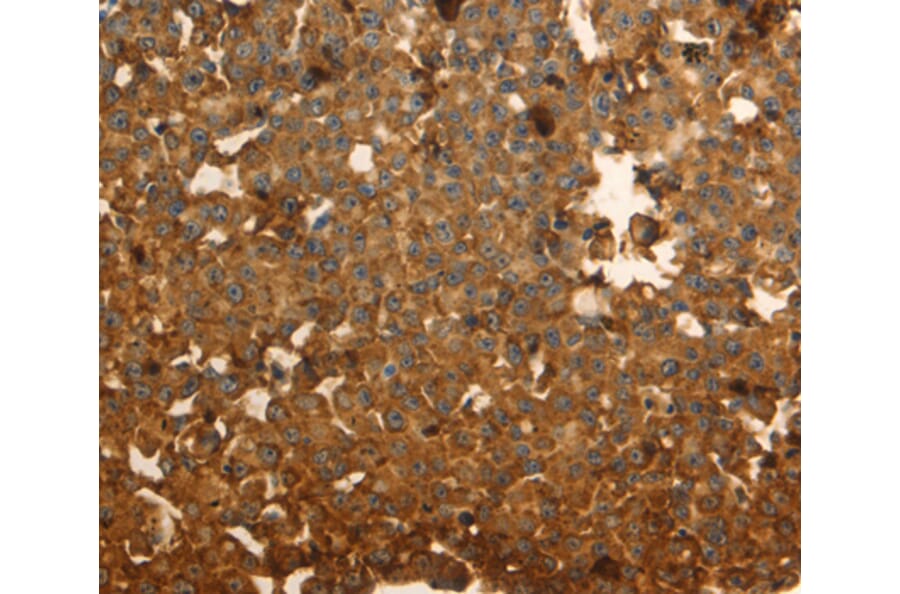 Immunohistochemistry - DRD5 antibody from Signalway Antibody (38612) - Antibodies.com