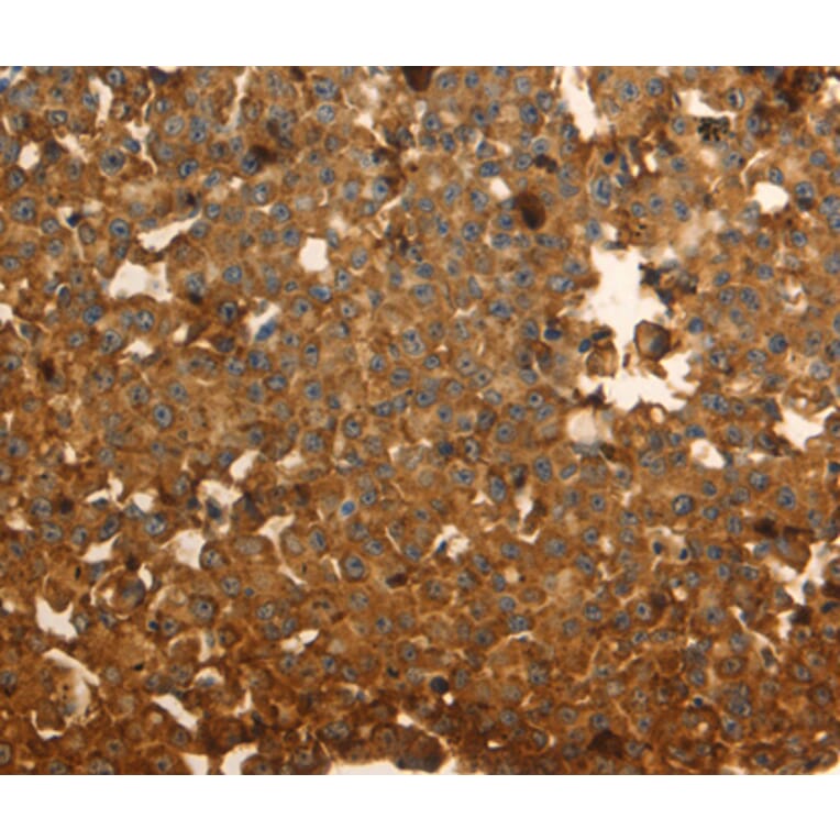 Immunohistochemistry - DRD5 antibody from Signalway Antibody (38612) - Antibodies.com