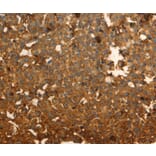 Immunohistochemistry - DRD5 antibody from Signalway Antibody (38612) - Antibodies.com