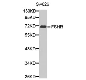 Western blot - FSHR antibody from Signalway Antibody (38614) - Antibodies.com