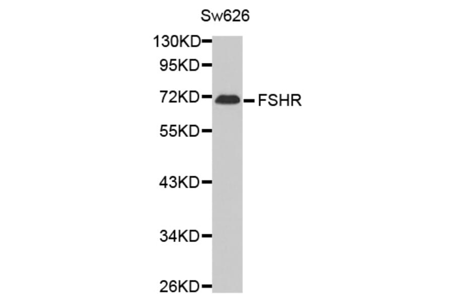 Western blot - FSHR antibody from Signalway Antibody (38614) - Antibodies.com