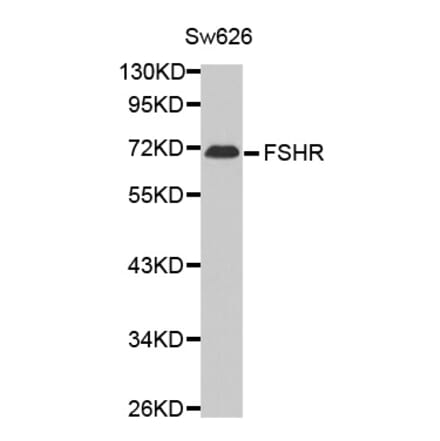 Western blot - FSHR antibody from Signalway Antibody (38614) - Antibodies.com