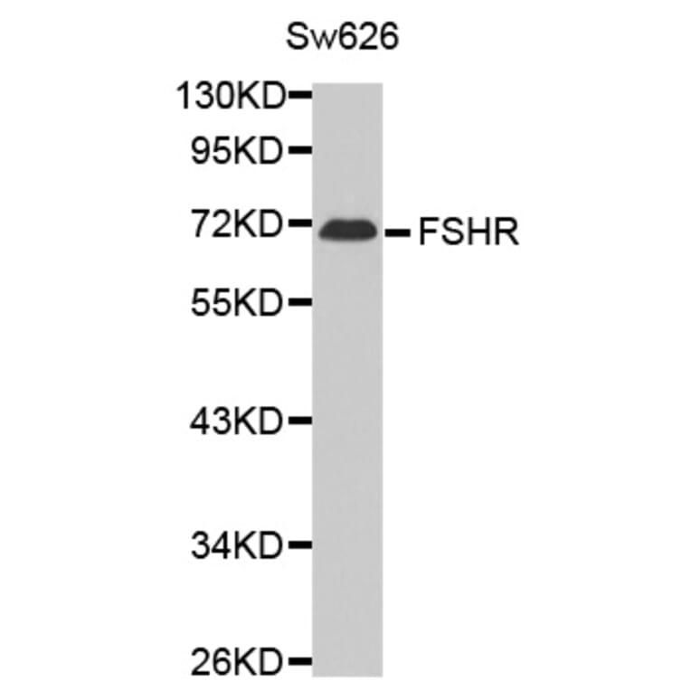 Western blot - FSHR antibody from Signalway Antibody (38614) - Antibodies.com
